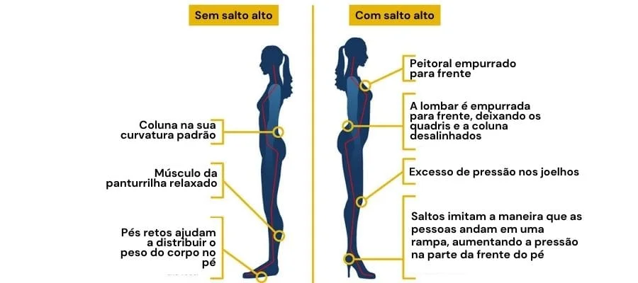 Salto Alto: 3 dicas para minimizar os